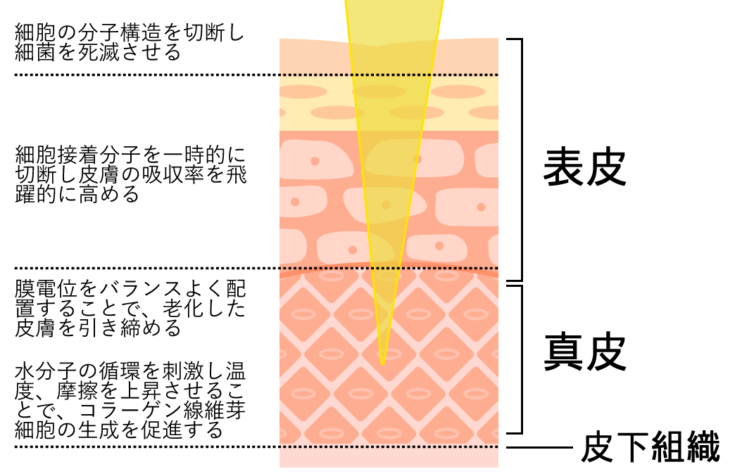 プラズマシャワーによる効果の仕組み