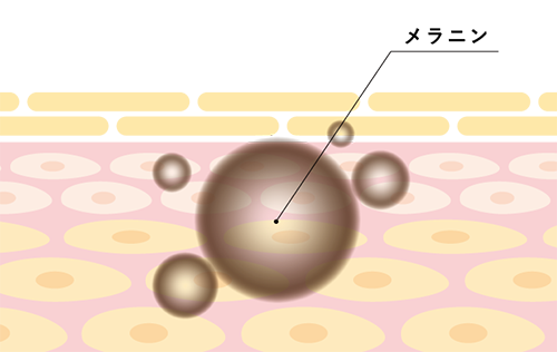 しみ・あざが発生