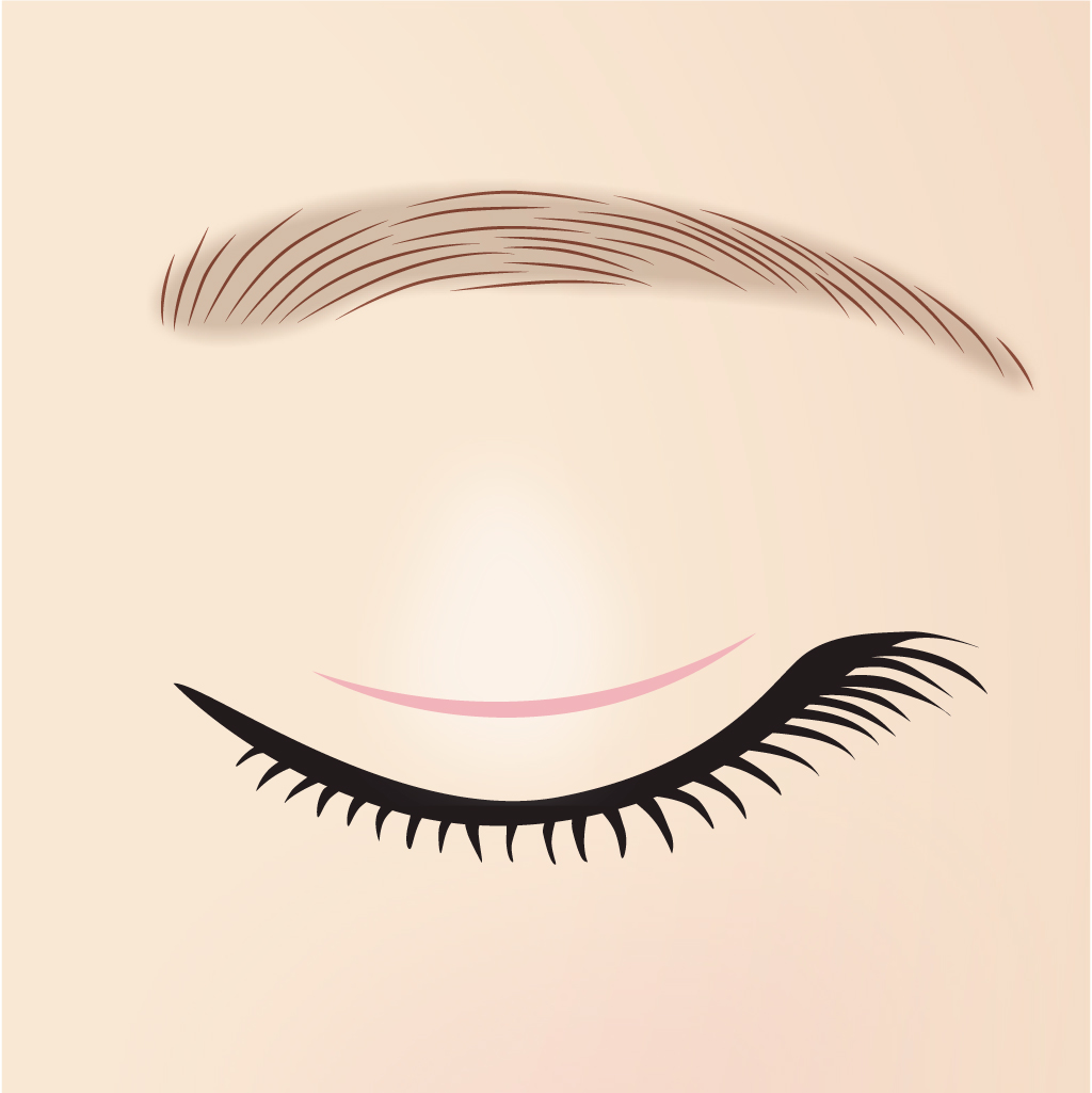 二重切開デザイン