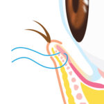 逆さまつ毛修正3