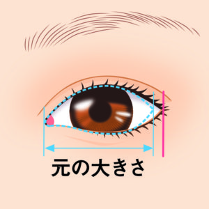 目尻切開の効果