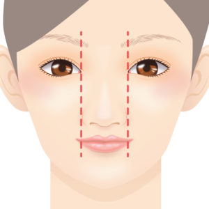 鼻翼縮小（小鼻縮小）とは