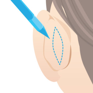 折れ耳デザイン