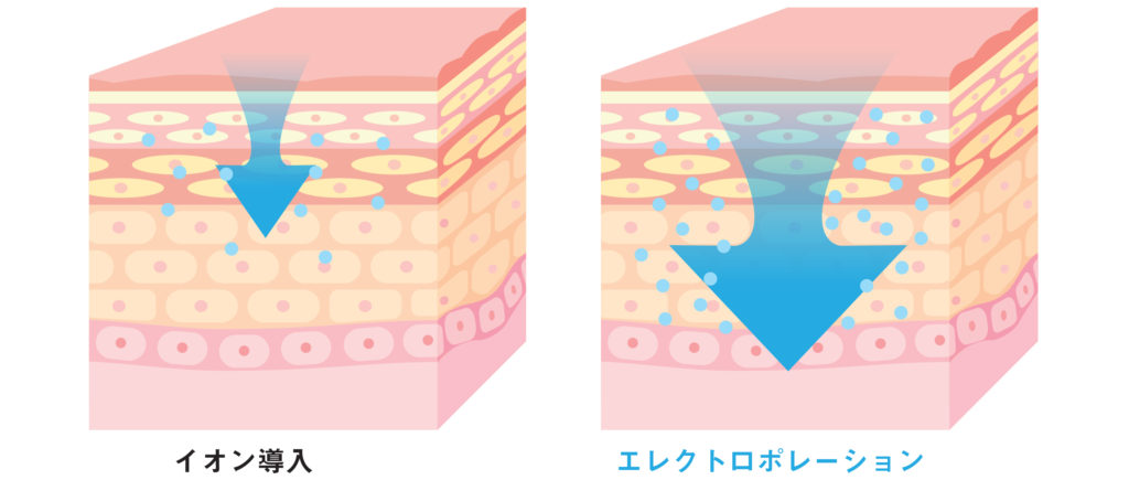 イオン導入とデルマシオ（エレクトロポレーション）の違い