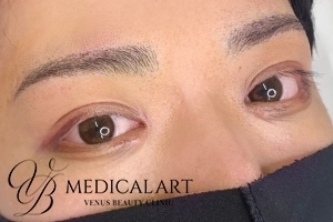 アートメイクアフター