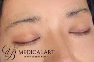 アートメイクビフォー