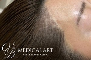 ヘアアートメイクAfter03