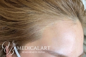 ヘアアートメイクAfter02