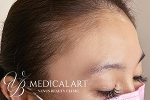 ヘアアートメイクBefore04