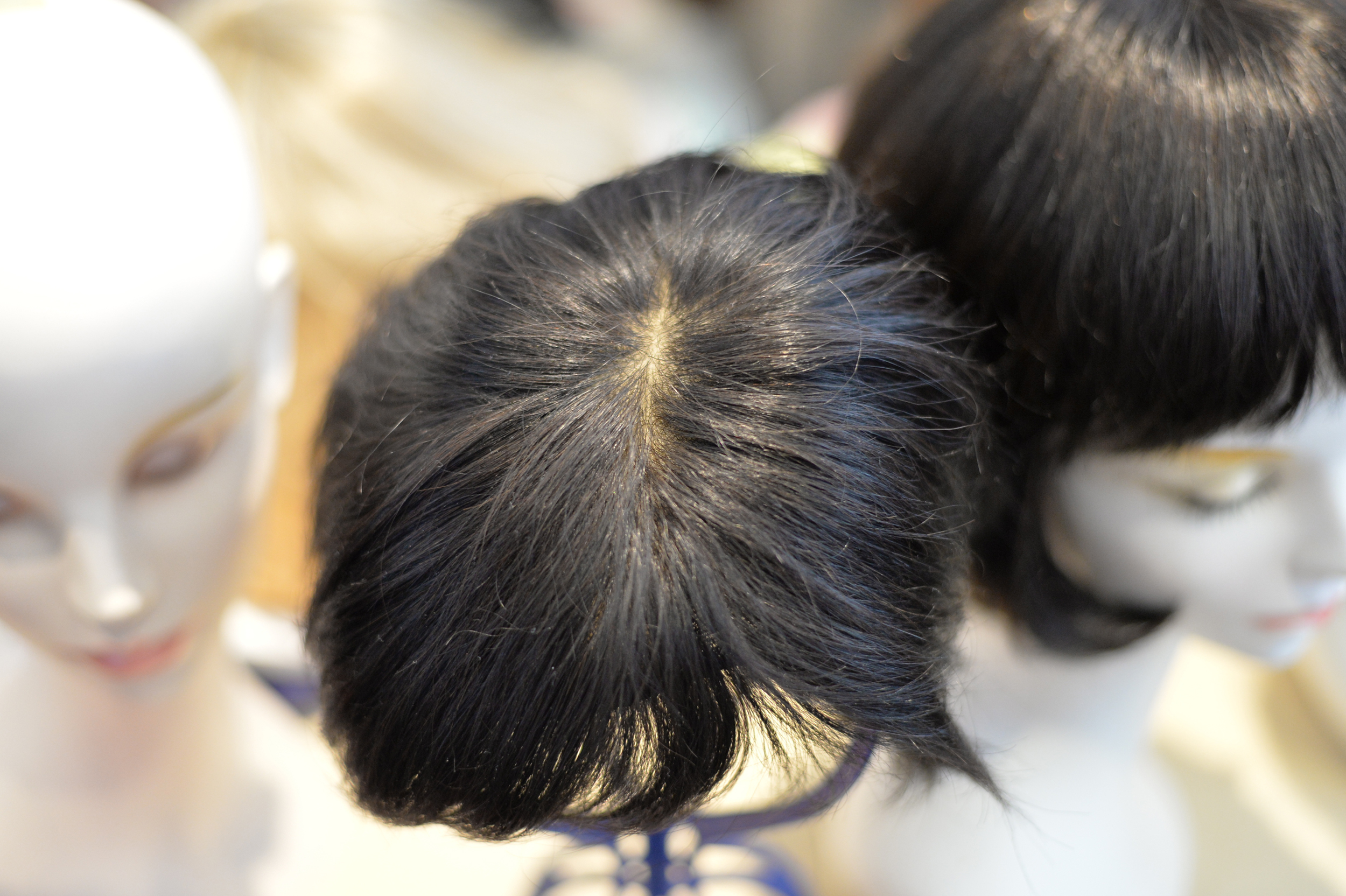 FAGAの他の対処法とヘアアートメイクの比較