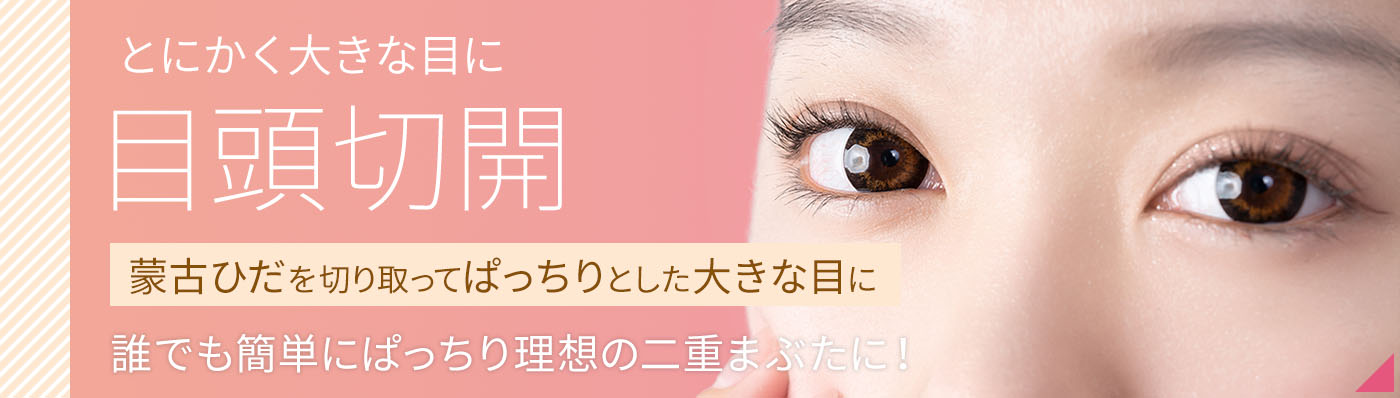目頭切開