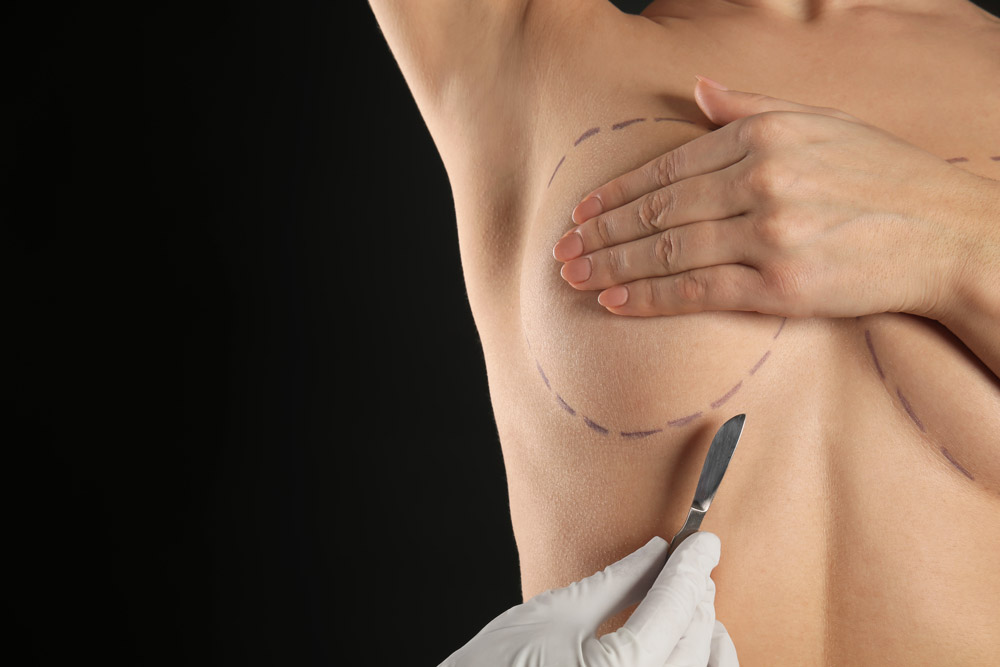 垂れた胸を戻すための施術