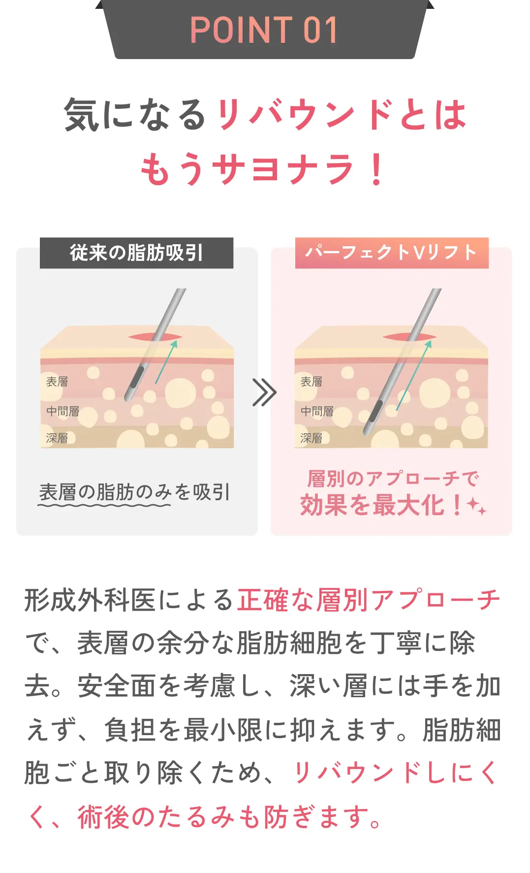 POINT 01 形成外科専門医による正確な層別アプローチで、表層だけでなく深層脂肪まで適切に処理！同時に行う糸リフトで皮膚と筋膜をしっかり固定するため、うれしい効果を長期間維持します。