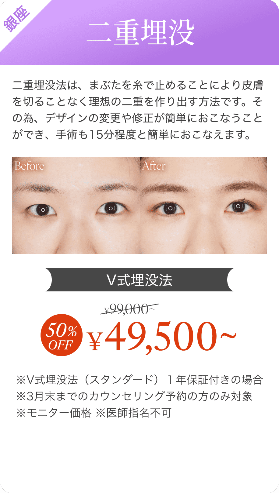 二重埋没40%オフ