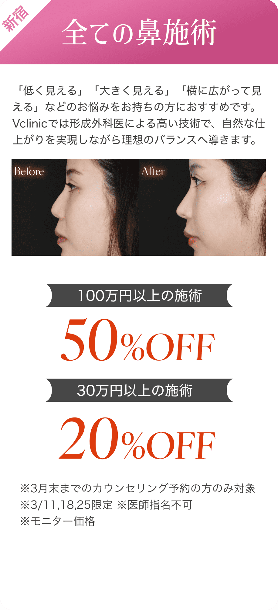 二重埋没40%オフ