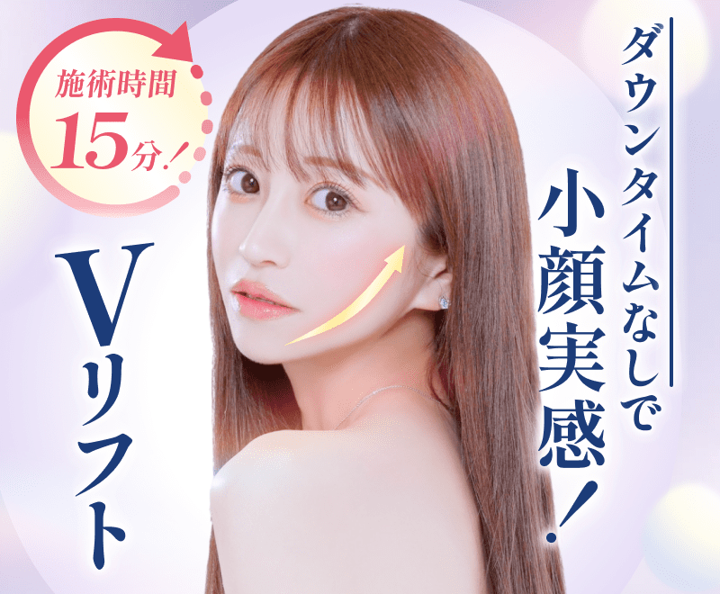 Vリフト(糸リフト6本)