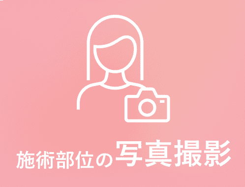 施術部位の写真撮影