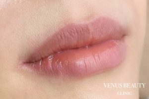 リップアートメイク 施術前