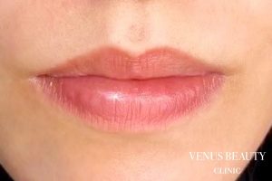 リップアートメイク 施術後