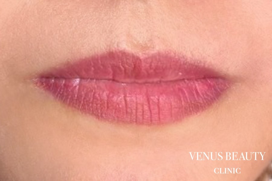 リップアートメイク 施術後