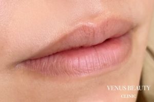 リップアートメイク 施術前