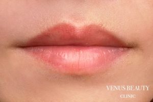 リップアートメイク 施術後