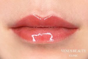リップアートメイク 施術後