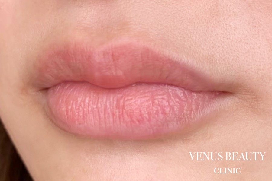 リップアートメイク 施術前