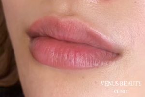 リップアートメイク 施術後