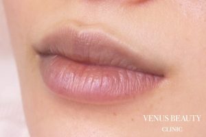 リップアートメイク 施術前