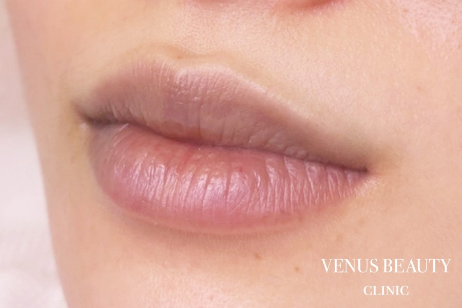 リップアートメイク 施術前