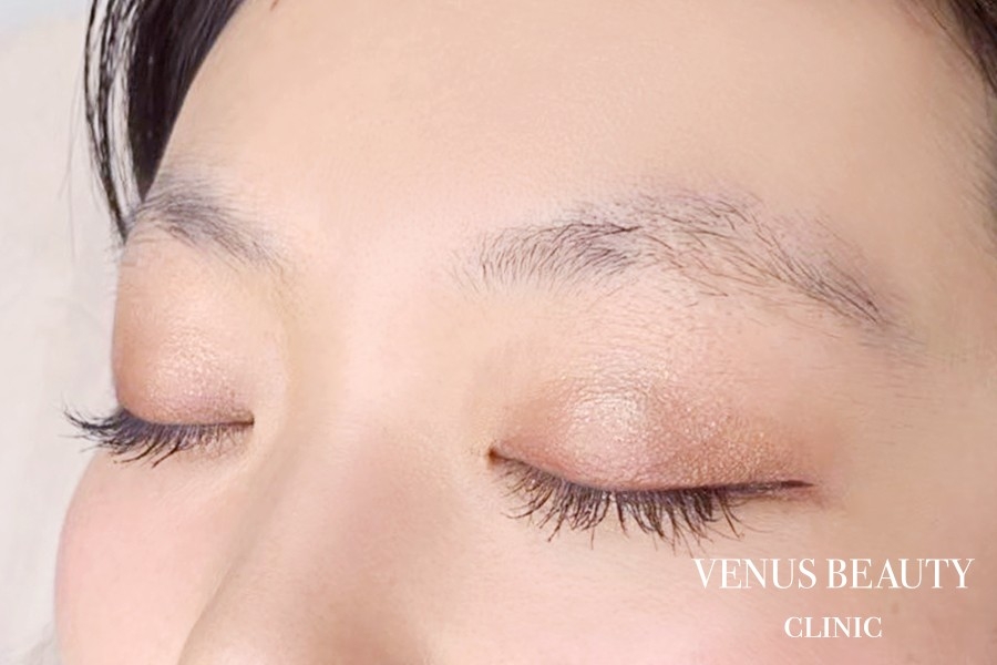 眉アートメイク症例一覧 施術前