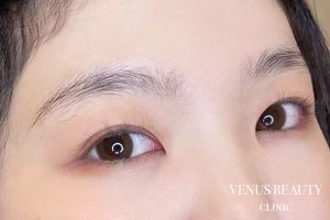 眉アートメイク症例一覧 施術前