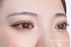 眉アートメイク症例一覧 施術後