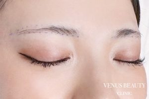 眉アートメイク症例一覧 施術前