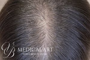 ヘアアートメイク症例一覧 施術後