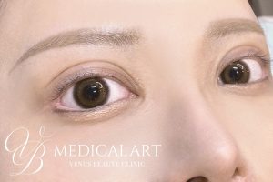 アイラインアートメイク 施術前