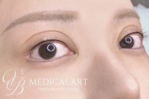 アイラインアートメイク 施術後