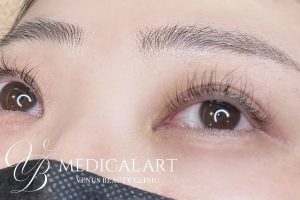 アイラインアートメイク 施術前