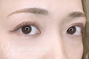 眉アートメイク症例一覧 施術後