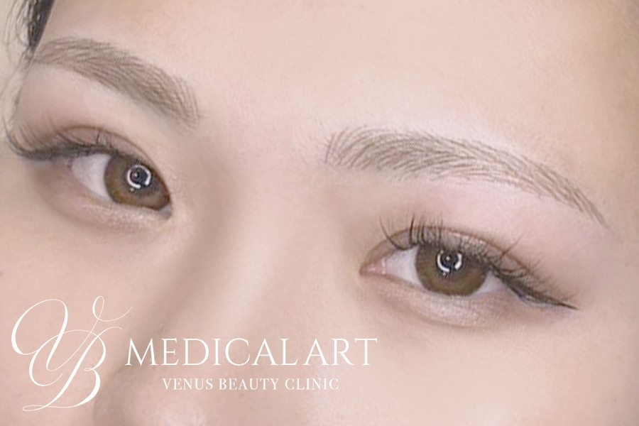 眉アートメイク症例一覧 施術後