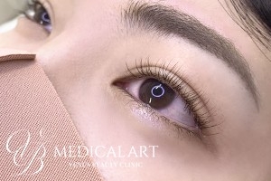 アイラインアートメイク 施術前