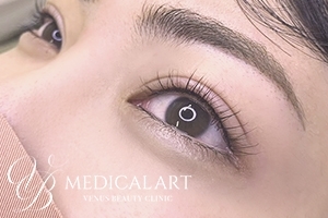 アイラインアートメイク 施術後