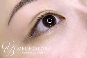 アイラインアートメイク 施術前