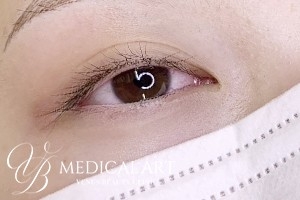 アイラインアートメイク 施術前