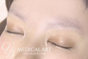 眉アートメイク症例一覧 施術前