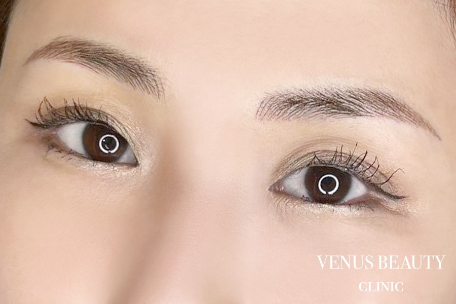 眉アートメイク症例一覧 施術後