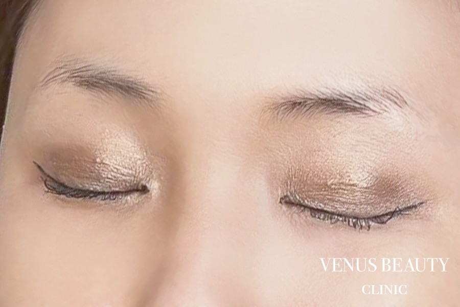 眉アートメイク症例一覧 施術前