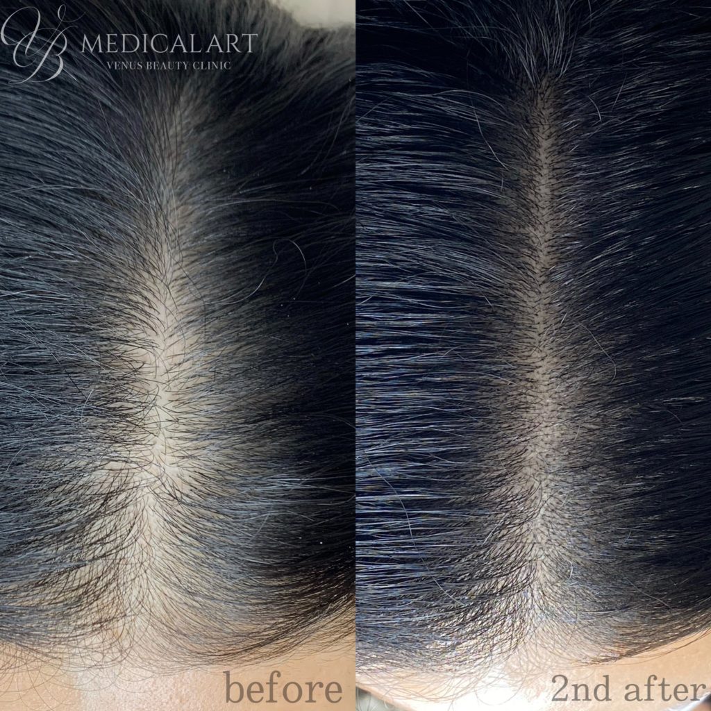 ヘアアートメイクとは？！メリットやデメリットも解説