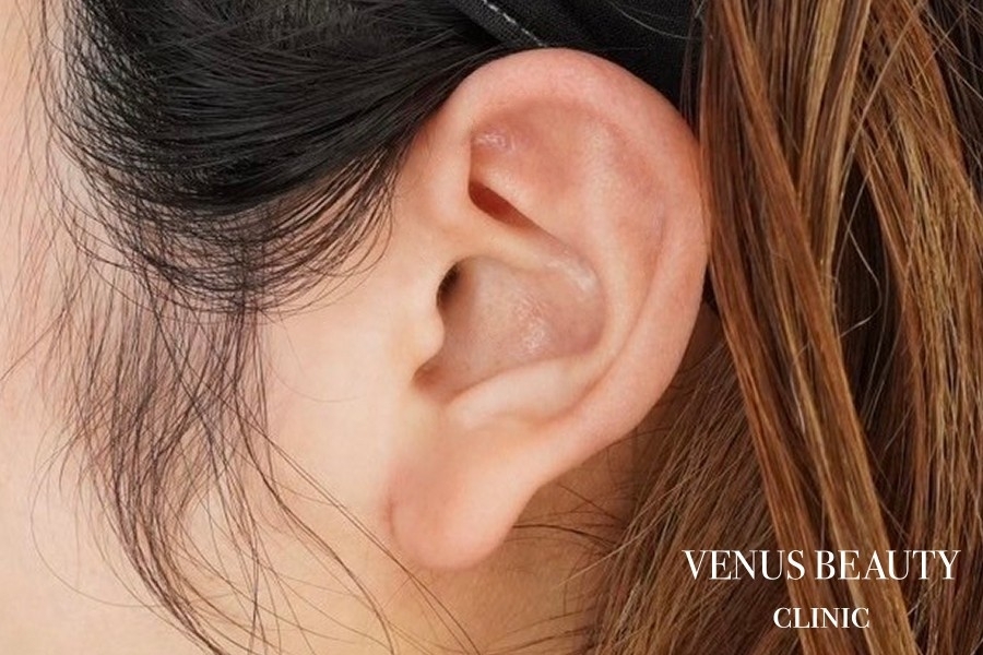 耳たぶ縮小術 施術前